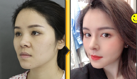 成都鼻子做的最好医生是哪个