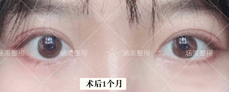 西安市眼鼻综合手术最好的医生