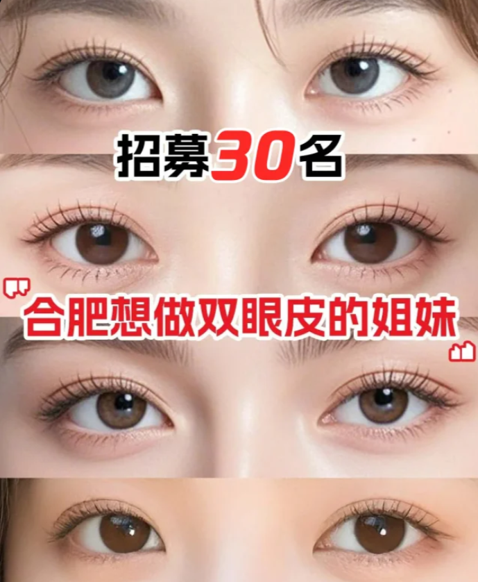 合肥双眼皮医生李继银、闫品行、朱邦中、曹林、朱慧茹、李树平哪个技术好？