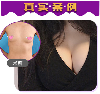 董岩岩_北京美莱整形美容中心医生